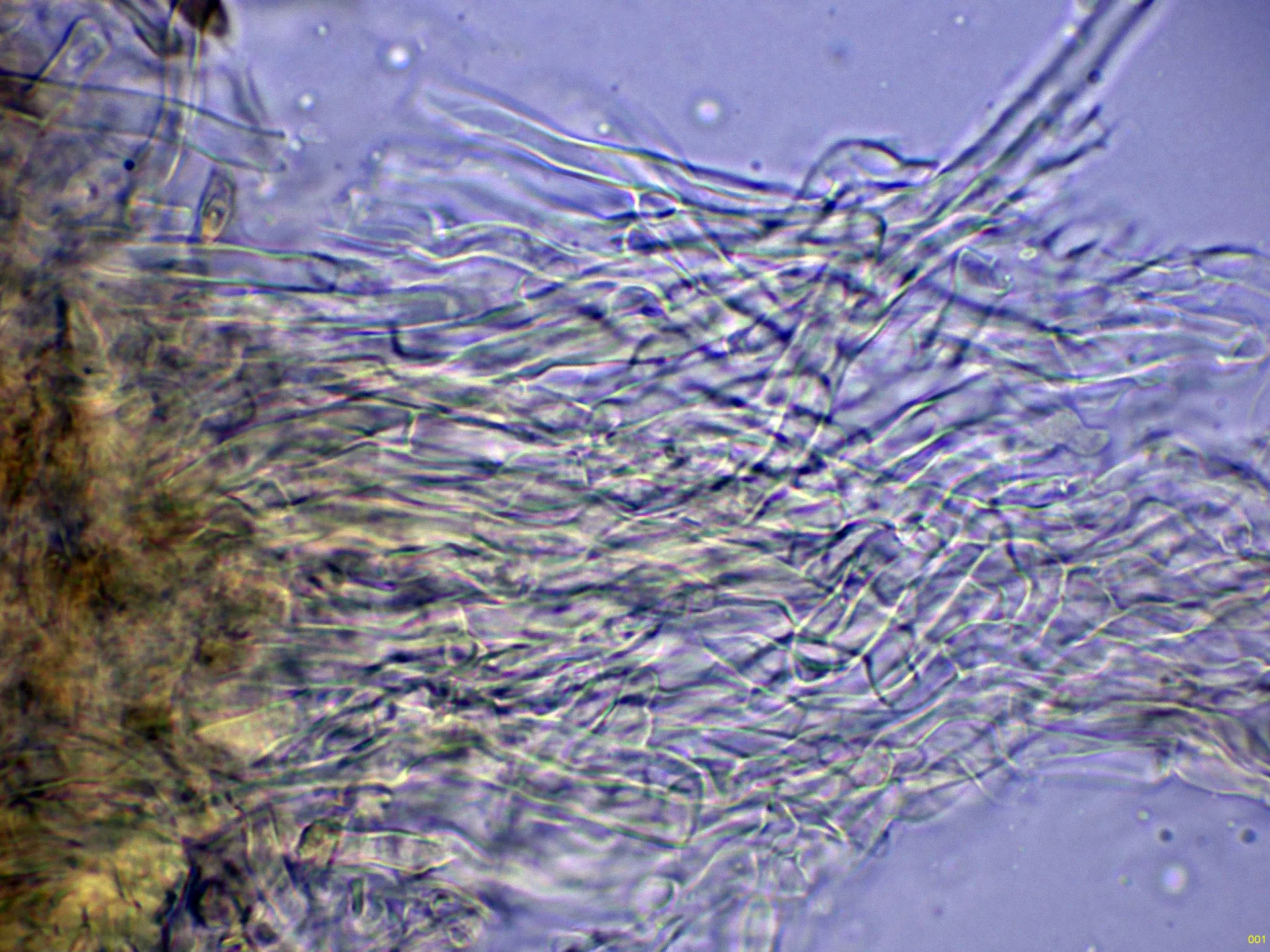 Microscopía de Rigidoporus crocatus - 10 - Hifas subiculares Melzer-001